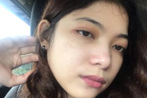Meningkatkan Kesehatan Kulit dengan Suplemen Kesehatan yang Berfungsi Ganda