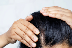 Mengulas Manfaat Kolagen bagi Kesehatan Rambut